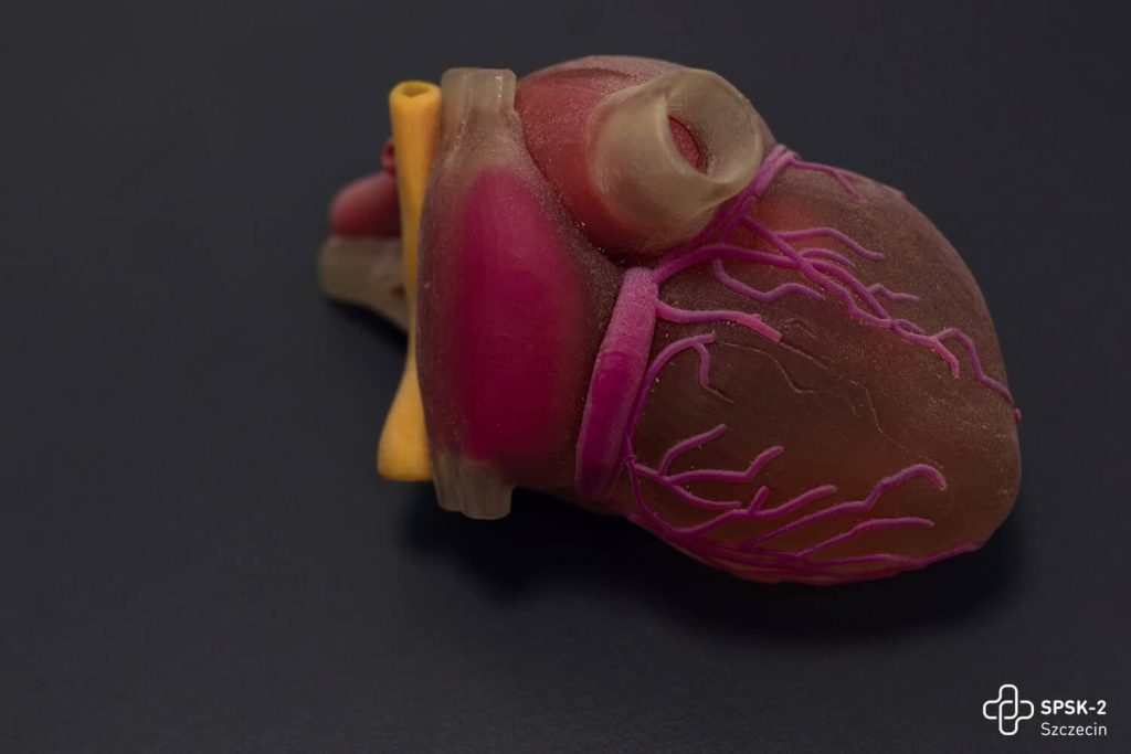 Wydruk modelu 3D serca 