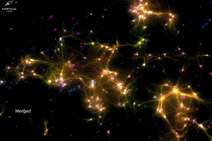 Gif pokazujący 4 obrazy mikroskopowych komórek nerwowych Dishbrain z różnokolorowymi znacznikami fluorescencyjnymi. Źródło: Cortical Labs