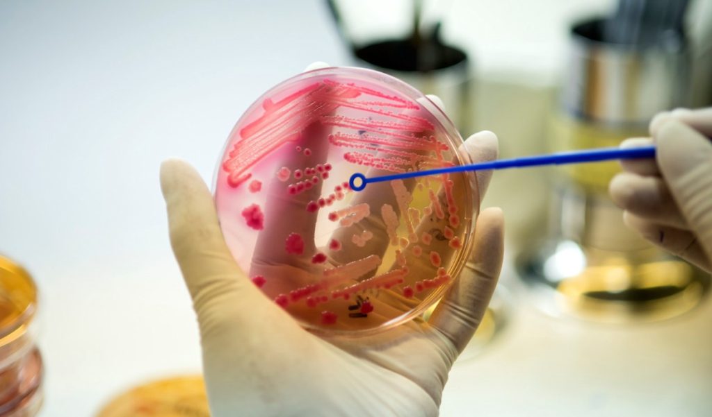W wyniku zakażenia bakteriami opornymi na dostępne antybiotyki, co roku w Europie umiera ok. 35 000 osób