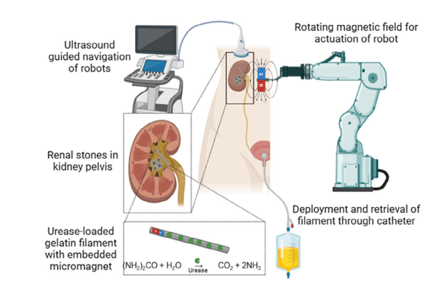 Wizualizacja robota do rozpuszczania kamieni nerkowych (zdjęcie: Advanced Healthcare Materials)