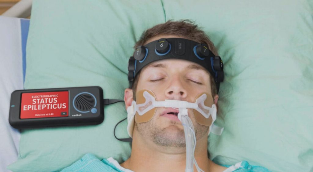 Małe EEG pozwala szybko wykryć stan padaczkowy niedrgawkowy (zdjęcie: Ceribell)