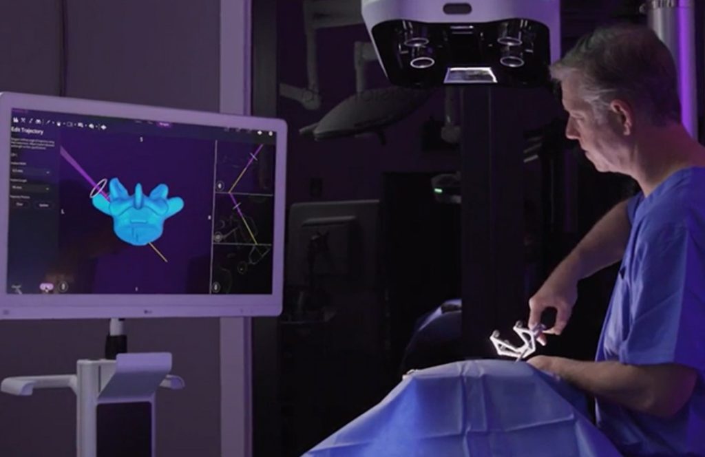 Proprio to nowy system nawigacji chirurgicznej (zdjęcie: Proprio)