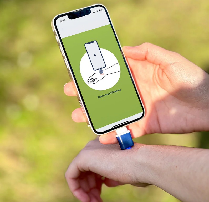 Wystarczy przyłożyć na chwilę Heat It do miejsca ukąszenia i po swędzeniu (zdjęcie: Heat It)