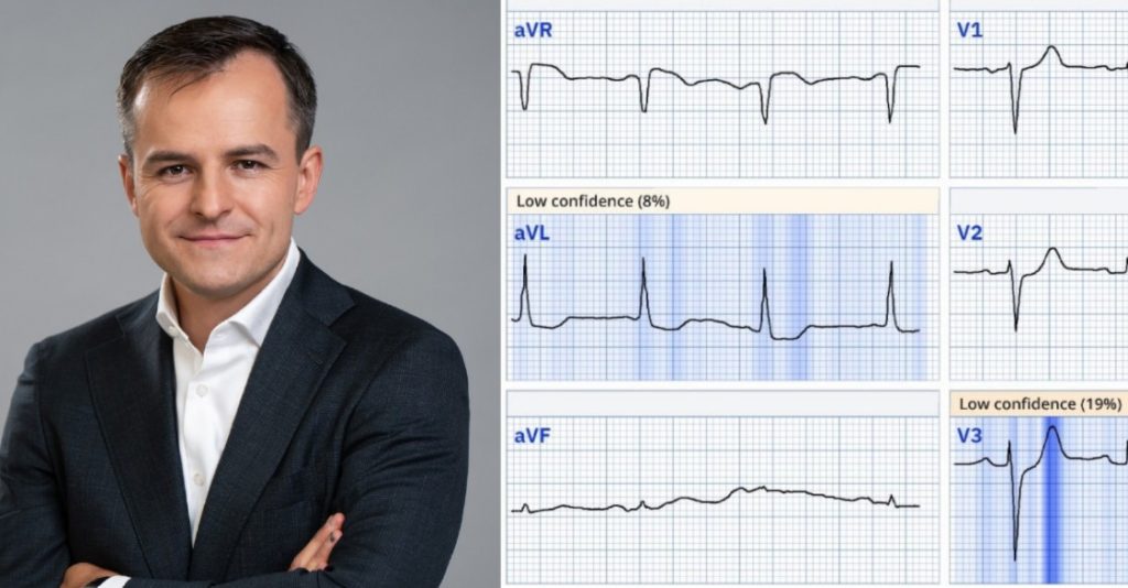 AI sprawia, że teraz lekarze POZ mogą wykonywać badania, wcześniej realizowane tylko przez kardiologów - mówi prof. dr hab. n. med. Łukasz Kołtowski 