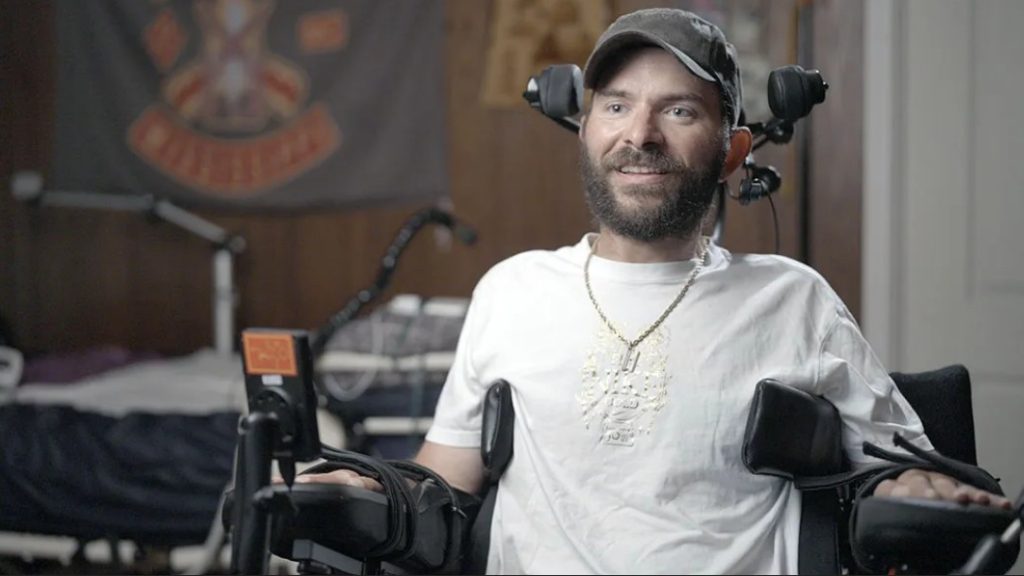 Pacjent o inicjałach RJ, który został sparaliżowany w wyniku urazu rdzenia kręgowego odniesionego w wypadku motocyklowym, jest piątym uczestnikiem badania PRIME (Precise Robotically Implanted Brain-Computer Interface) firmy Neuralink. Implant ma przywrócić zdolności komunikacji z otoczeniem.