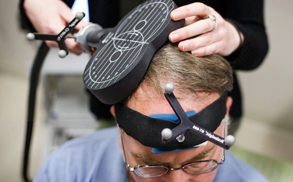 Neurostymulacja daje obiecujące wyniki w leczeniu depresji, ale nadal jest dostępna tylko prywatnie (zdjęcie: Stanford Medicine)