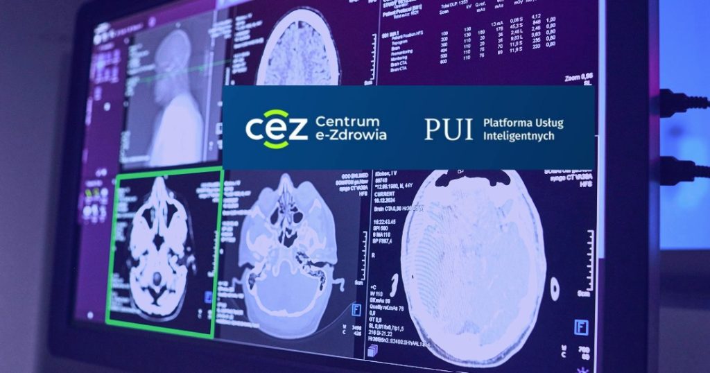 Platforma Usług Inteligentnych działa jak „sklep z aplikacjami”. Szpitale będą mogły instalować według potrzeb certyfikowane algorytmy sztucznej inteligencji